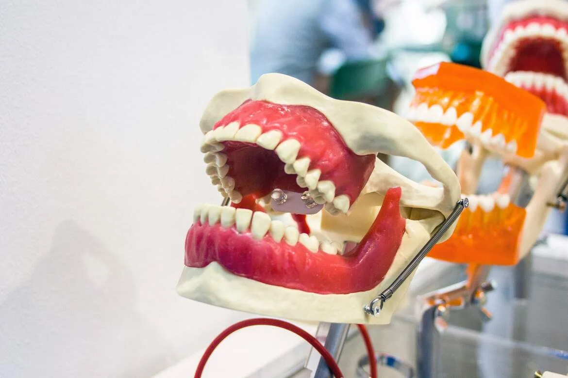 Dental Implants vs Bridges vs Dentures — illustrative image