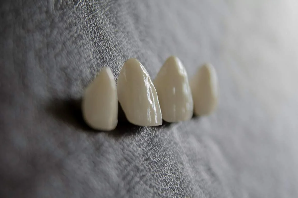 Who Is Not a Candidate for Implants? — illustrative image