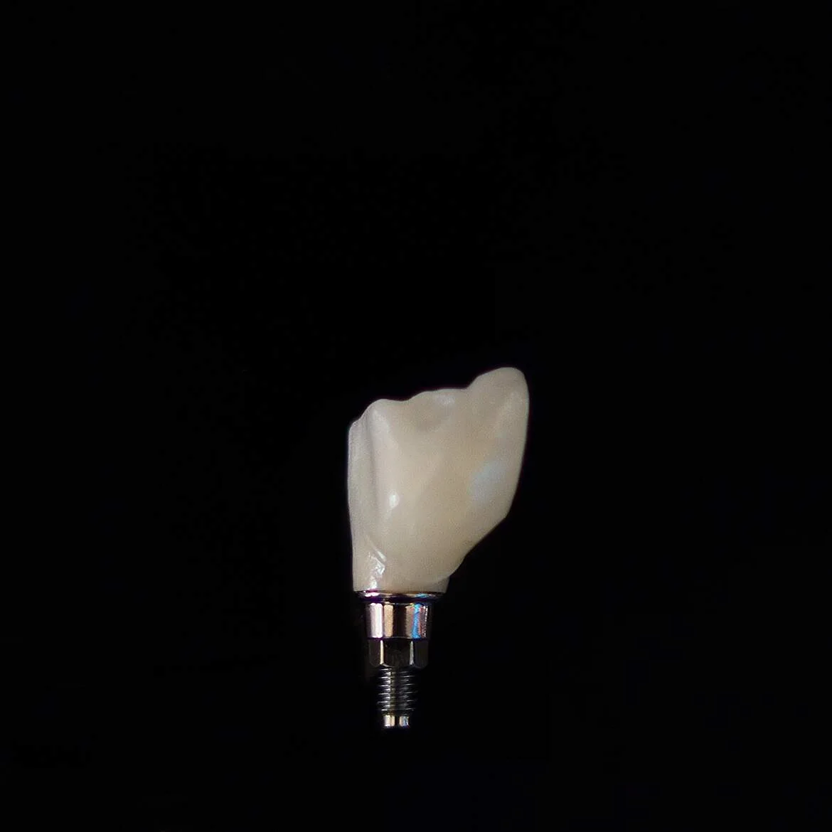 Types of Dental Implants — illustrative image